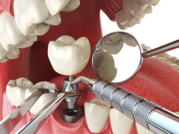 Best Cosmetic Emergency Dentistry in Montegut, LA